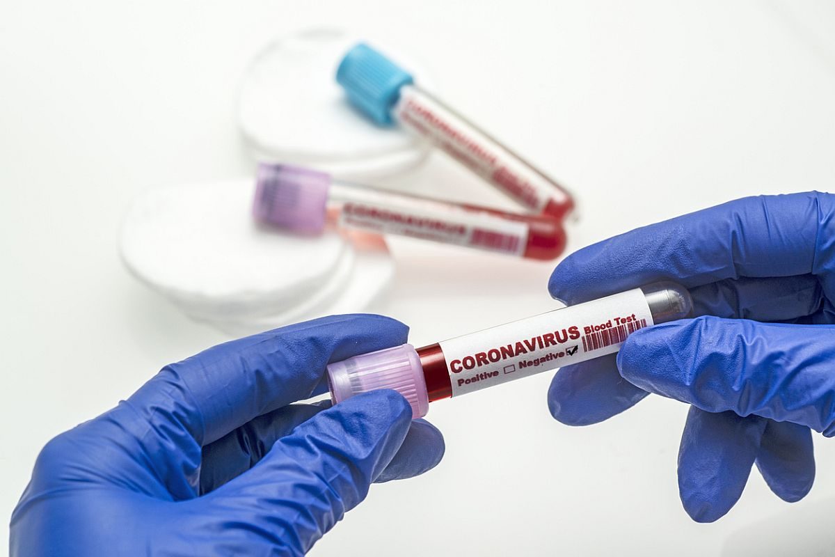 Coronavirus blood test .  Coronavirus negative blood in laboratory.